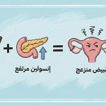 لماذا يسبب تكيس المبايض نمو شعر اللحية عند النساء؟